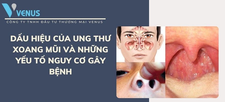 Nhận biết ung thư xoang mũi và cách điều trị