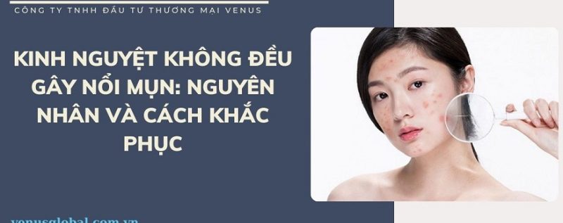 Cách khắc phục kinh nguyệt không đều gây nổi mụn