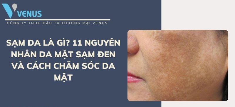 Nguyên nhân khiến da mặt sạm đen, cách chăm sóc da mặt khỏi sạm nám