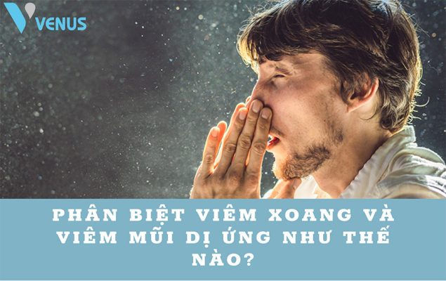 Phân biệt viêm xoang và viêm mũi dị ứng