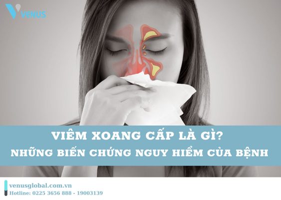 Tìm hiểu về bệnh viêm xoang cấp và những biến chứng