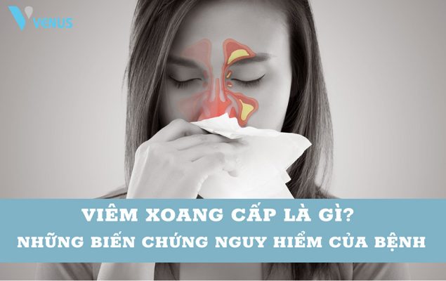 Tìm hiểu về bệnh viêm xoang cấp và những biến chứng